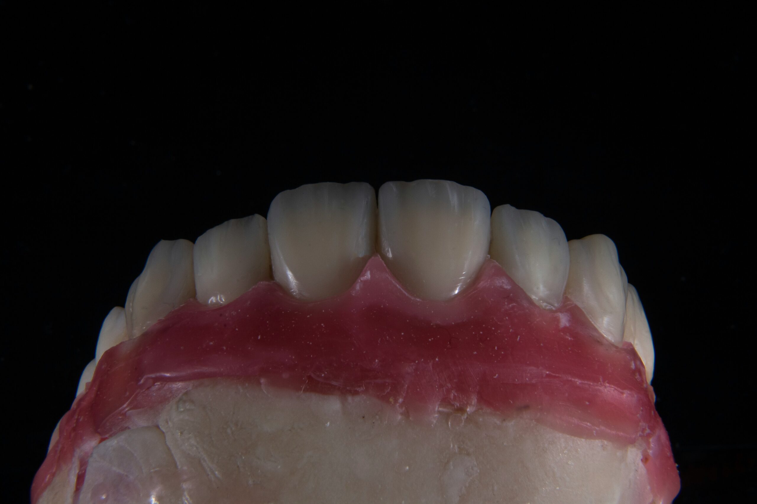 Close-up of a colorful dental toy with ridges and bumps