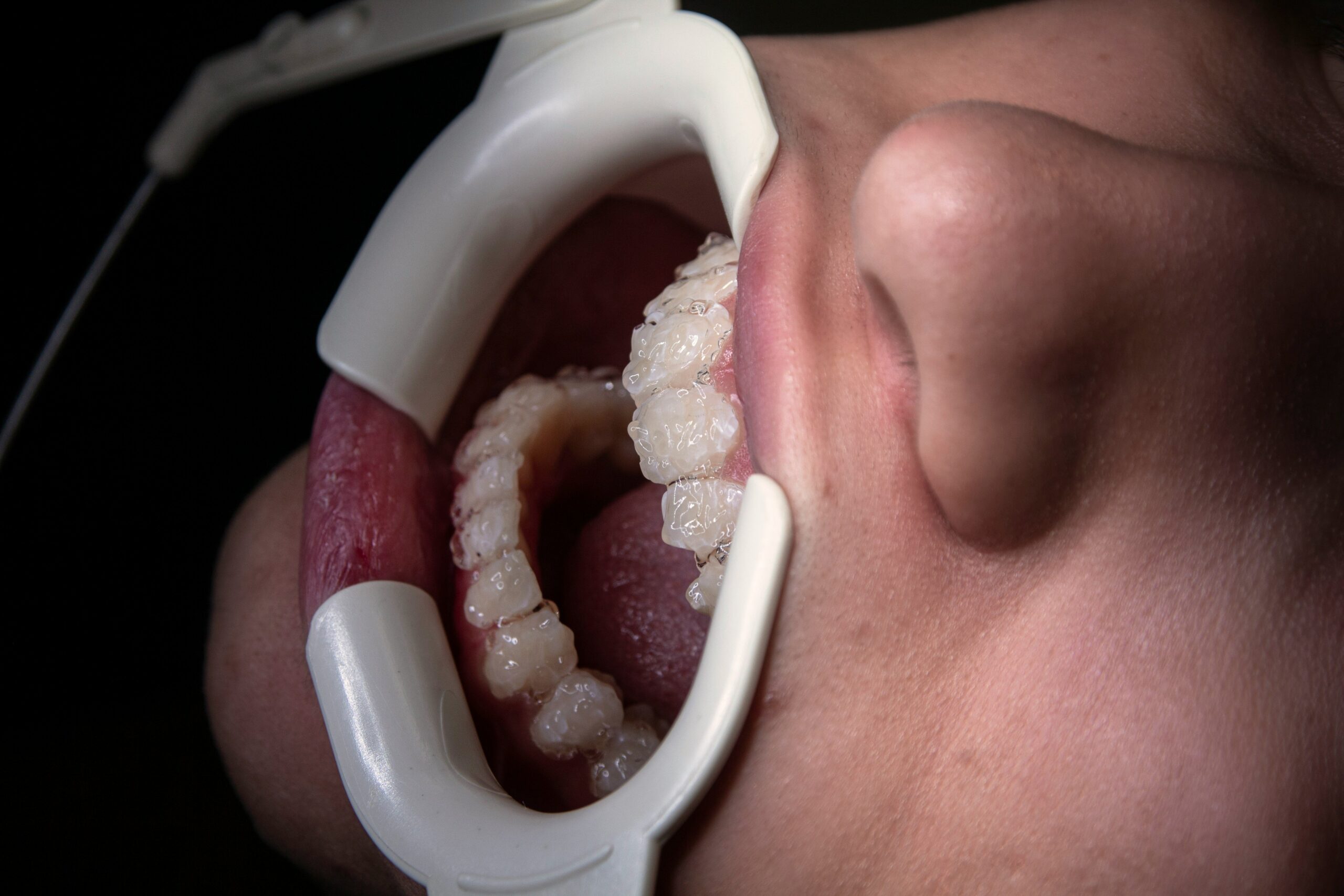 Why Enzyme-Coated Toys Are a Game-Changer for Your Pet’s Dental Health